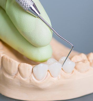 dentist designing a dental bridge