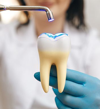 Dentist demonstrating dental bonding on large model tooth