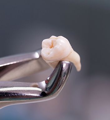 knocked out tooth