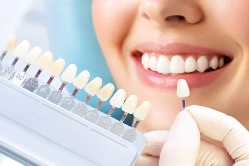 A woman using a tooth shade guide at the dentist
